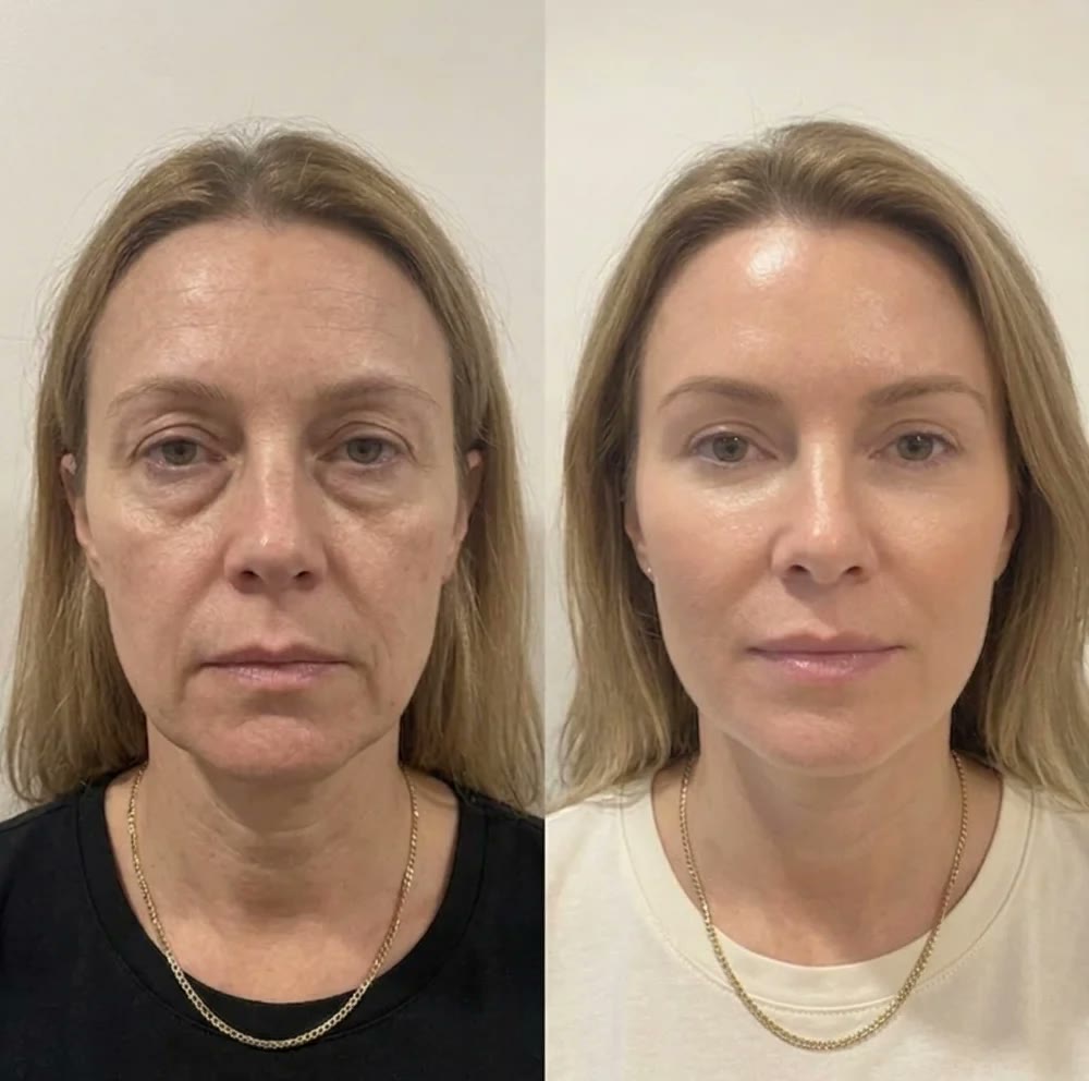 Kundbild av Lovelle Glow